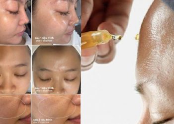 Dermalogica Ra Mắt LuminFusion: Đột phá mới trong liệu trình chăm sóc da đặc trị không xâm lấn mang lại làn da rạng rỡ vượt bậc