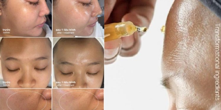 Dermalogica Ra Mắt LuminFusion: Đột phá mới trong liệu trình chăm sóc da đặc trị không xâm lấn mang lại làn da rạng rỡ vượt bậc