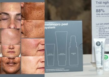 Cải thiện tình trạng nám da sau 6 tuần với giải pháp Powerbright Dark Spot Peel từ Dermalogica và Viện nghiên cứu về da quốc tế IDI Hoa Kỳ